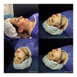 کلینیک جراحی سوپرکانتورینگ غبغب وی لاین