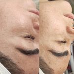 آموزش و خدمات پوست و فیشال رویا باقریان