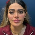 کلینیک زیبایی الینا رز
