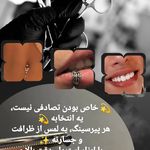 استارلیت پیرسینگ
