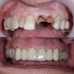 دنداپزشکی دکتر یاشار معزز