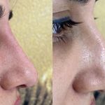 کلینیک زیبایی الماس کاملا اقساطی