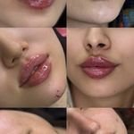 کلینیک لاویز