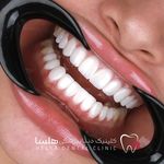کلینیک دندانپزشکی هلسا(اقساط)