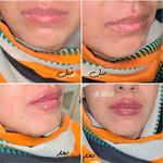 مرکز لیزر نهال