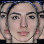 فتوگرافی پزشکی مظلومی