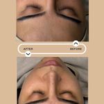 خدمات تخصصی فیشیال مهسا پورنجف