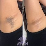 مرکز لیزر و کلینیک زیبایی آروین