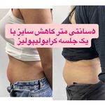 کلینیک زیبایی ،لیزر و لاغری گل مریم
