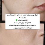 کلینیک فیشال و ماساژ سارن اسکین سارا