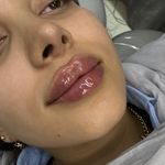 کلینیک زیبایی و جوانسازی پوست و مو الین