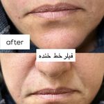 كليه خدمات زیبایی مرضیه لطفی