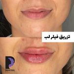 کلینیک زیبایی پوست و مو و لیزر پامچال