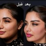 کلینیک زیبایی و فیشال ویونا سلامت