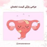 دکتر مردمک راوری