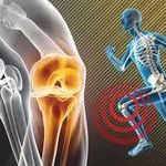 فیزیوتراپی آراز