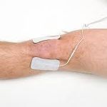 فیزیوتراپی آراز