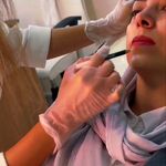 کلینیک پوست و مو لیزر شیلربیوتی