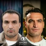 کلینیک پوست مو و زیبایی نوین ایرانا