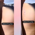 کلینیک پوست و مو و لیزر نیلوفر آبی