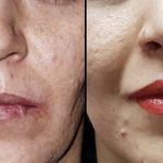 کلینیک زیبایی الماس کاملا اقساطی