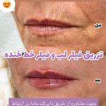 مطب زیبایی خانم محمدرضایی پوست ومو
