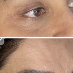 کلینیک زیبایی الماس کاملا اقساطی