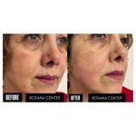 کلینیک پوست مو و زیبایی رکسانا