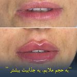 کلینیک پوست وزیبایی ومرکز تخصصی فیلربادی