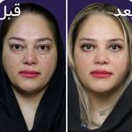 کلینیک زیبایی الماس کاملا اقساطی