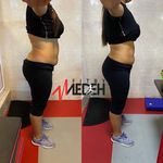 ایکسبادی - ای ام اس (EMS) پیروزی