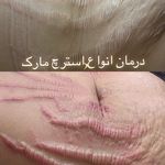 سالن زیبایی تخصصی نیلامیر