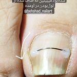 خدمات تخصصی_درمانی ناخن بهشاد داودی
