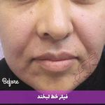 کلینیک زیبایی درمانی به تن رو