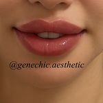 مطب پوست مو زیبایی و لاغری ژن شیک