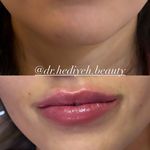 کلینیک زیبایی دکتر هدیه دهقانپور