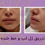 دکتر مینو مومنی