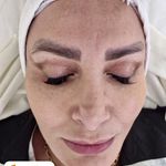 خدمات تخصصی پاکسازی پوست رویال اسکین