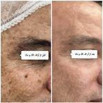 کلینیک پوست و مو بلانژ