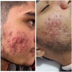 فیشال و پاکسازی شیرین نصیری درمالند