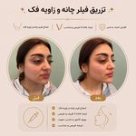 مطب زیبایی دکتر نلسا