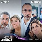 کلینیک پوست مو و زیبایی نوین ایرانا