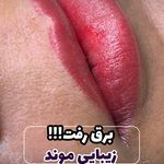میکروکیماسی( میکروابرو چشم لب،ریمو)