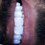 دکترای پروتزهای دندانی اکبری