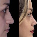 مرکز جراحی زیبایی بینی