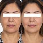مرکز تخصصی زیبایی و لیزر دمور