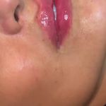 کلینیک زیبایی دریا/دکتر امیر قهرمانی