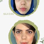 کلینیک لیزر  کندلاوزیبایی پوست ومو آیشیل