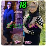 مراکز تخصصی لاغری و زیبایی گرين لايف