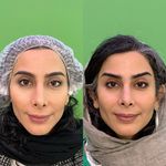 کلینیک زیبایی و لیزر دکتر آزاده اسماعیلی